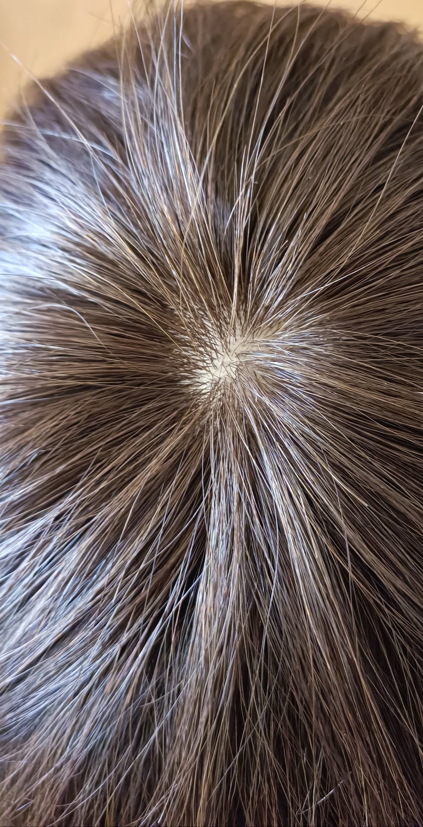 Short Natural Look Human Hair Wig | Breathable Lace | Glueless